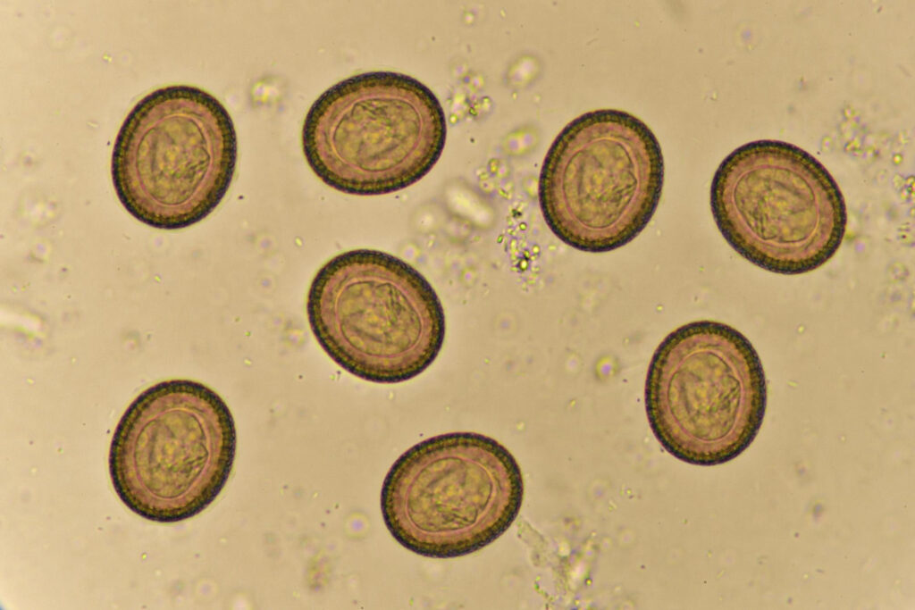 Análisis coprológico huevo-taenia-o-lombriz-cinta-heces-humanas-analizado-microscopio